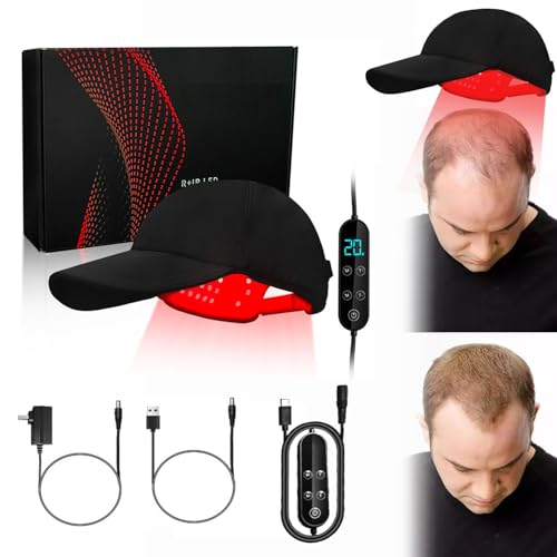 Crecimiento Del Cabello Terapia De Luz Roja