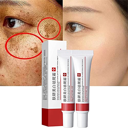 2Pcs Whitening Freckle Cream,Acne Scar Removal